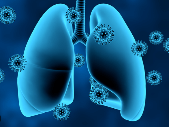 How to Improve Lung Health