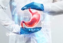 Endoscopy Transforms Healthcare