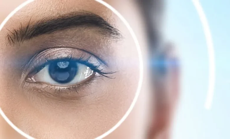 LASIK Surgery in Dubai