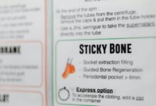 using hip5 4 1hiez effectively